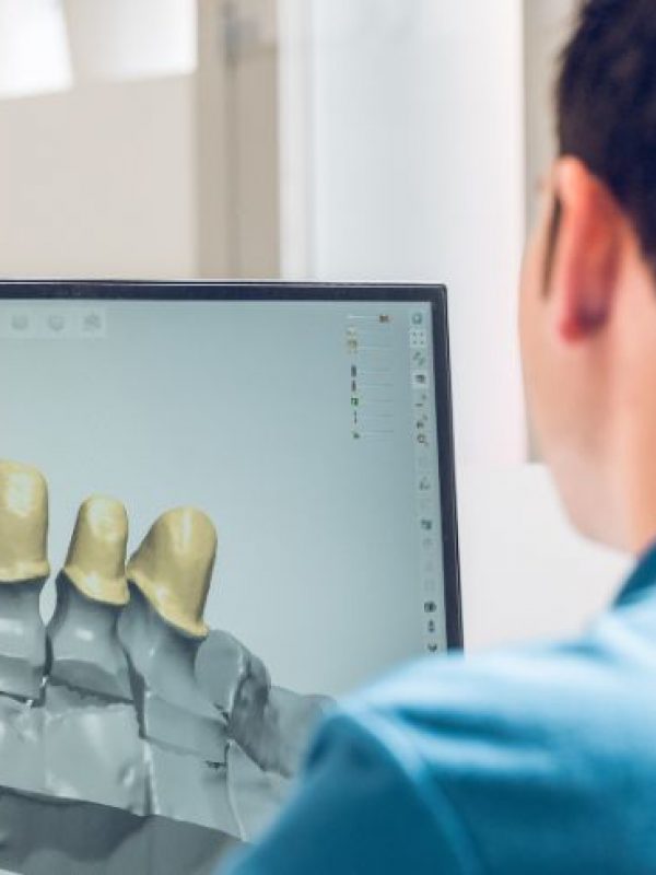 Experto en Cerámica dental y Diseño Digital CAD-CAM
