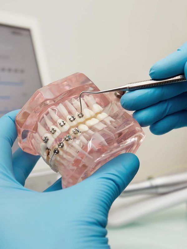 Monográfico de iniciación en ortodoncia de laboratorio